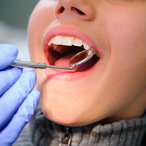 A person with open mouth receiving dental care, likely a cleaning or filling procedure, under the supervision of a dental professional using specialized tools.
